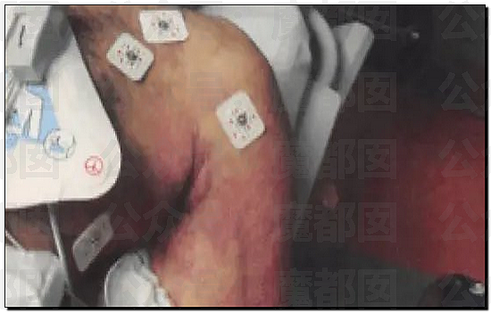 外网吵翻！爱泼斯坦最新自杀照片公布！诸多疑点？竟然没死（视频/组图） - 12