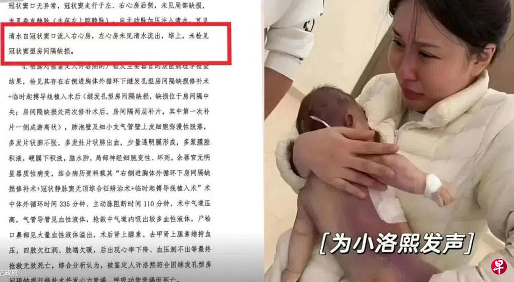 宁波“小洛熙”事件调查结果公布：系一级甲等医疗事故，涉事医生吊销执照，院长免职（视频/图） - 1