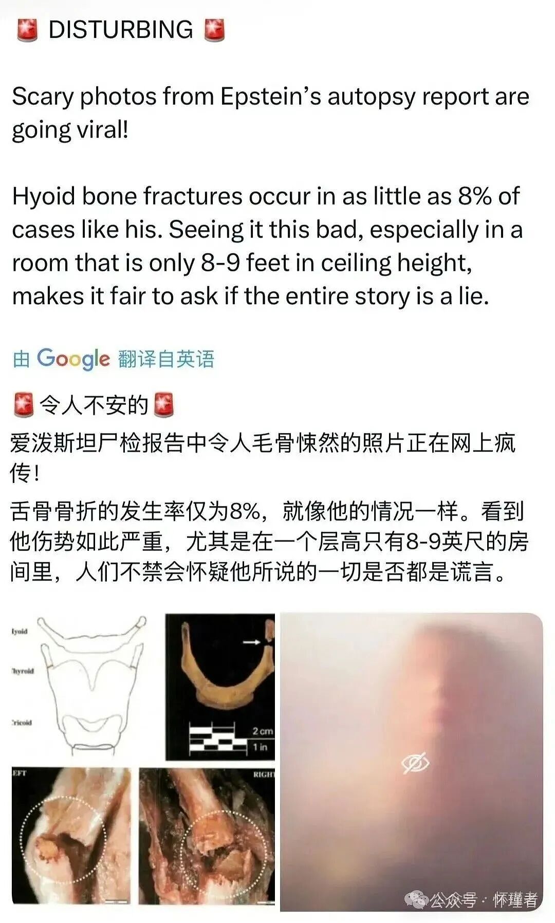 萝莉岛最新文件解密：爱泼斯坦和马斯克私密邮件+疑似假死证据曝光（组图） - 11