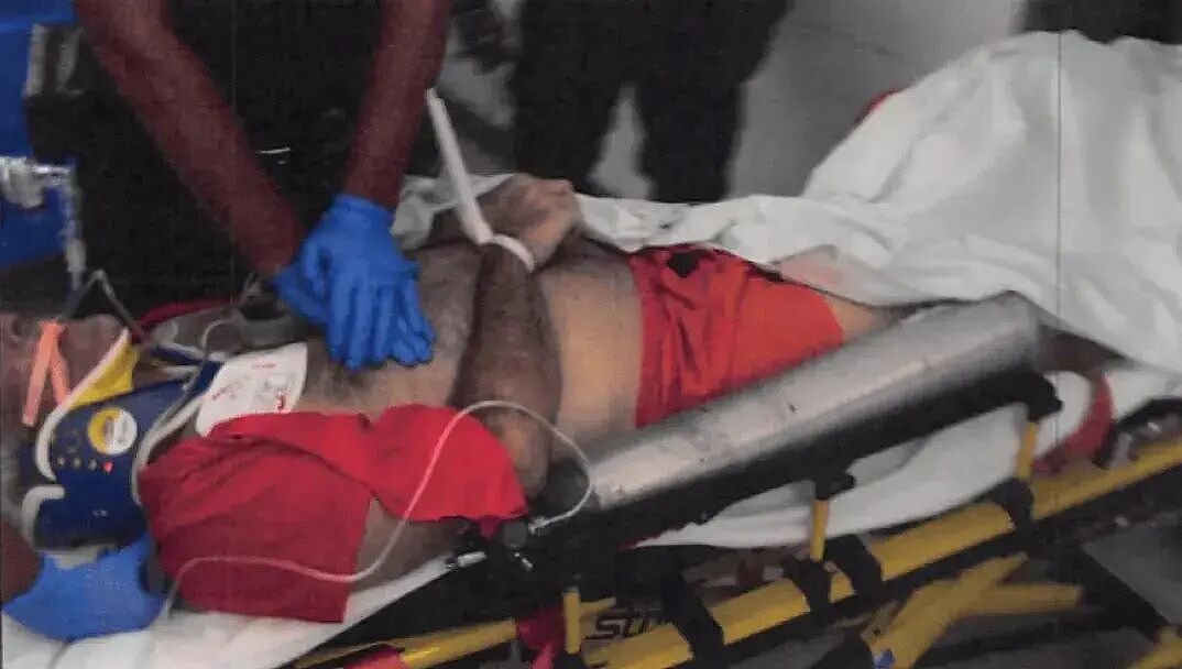 爱泼斯坦死亡当天抢救照片曝光！鼻子文身都对不上本人？网友：死的真是他吗（组图） - 9