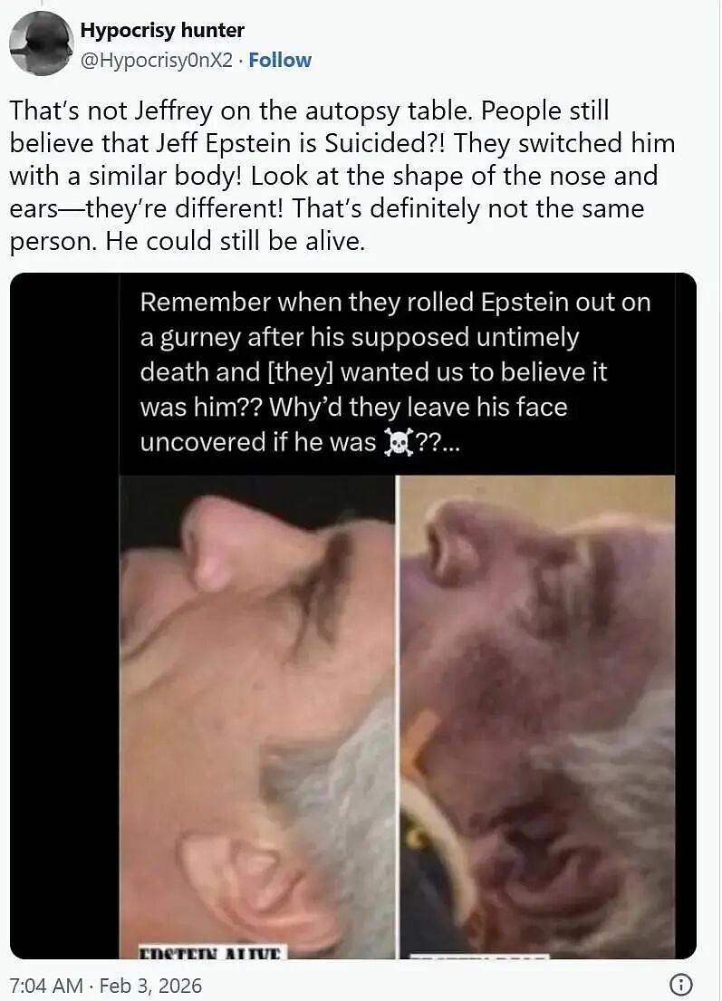 爱泼斯坦死亡当天抢救照片曝光！鼻子文身都对不上本人？网友：死的真是他吗（组图） - 21