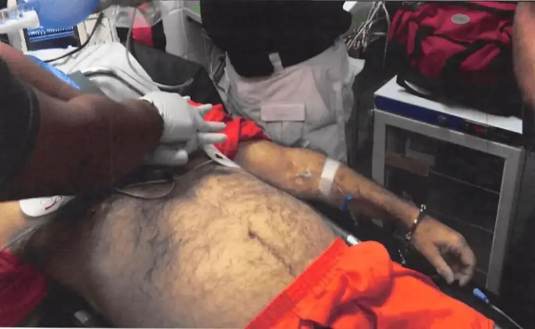 爱泼斯坦死亡当天抢救照片曝光！鼻子文身都对不上本人？网友：死的真是他吗（组图） - 12