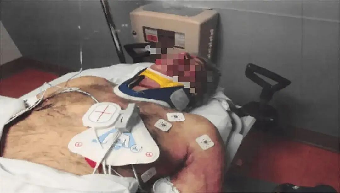 爱泼斯坦死亡当天抢救照片曝光！鼻子文身都对不上本人？网友：死的真是他吗（组图） - 17