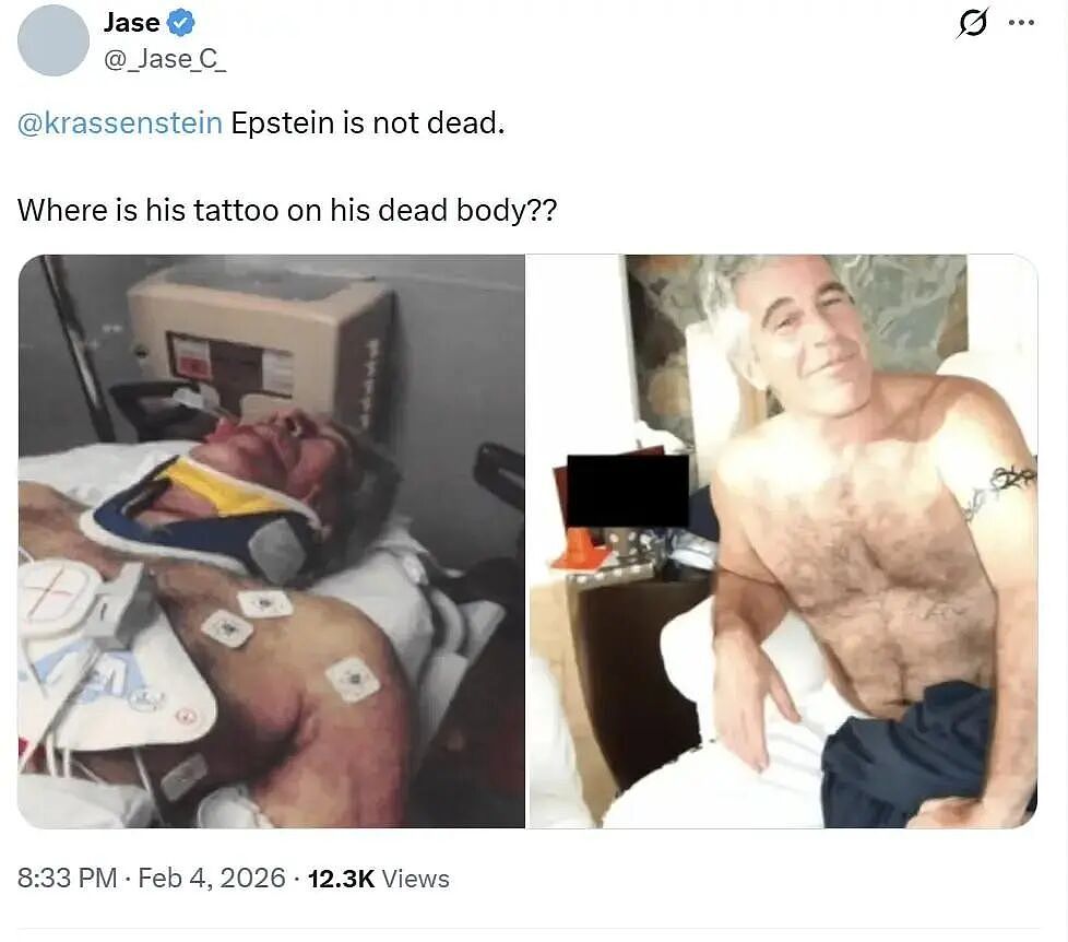 爱泼斯坦死亡当天抢救照片曝光！鼻子文身都对不上本人？网友：死的真是他吗（组图） - 23