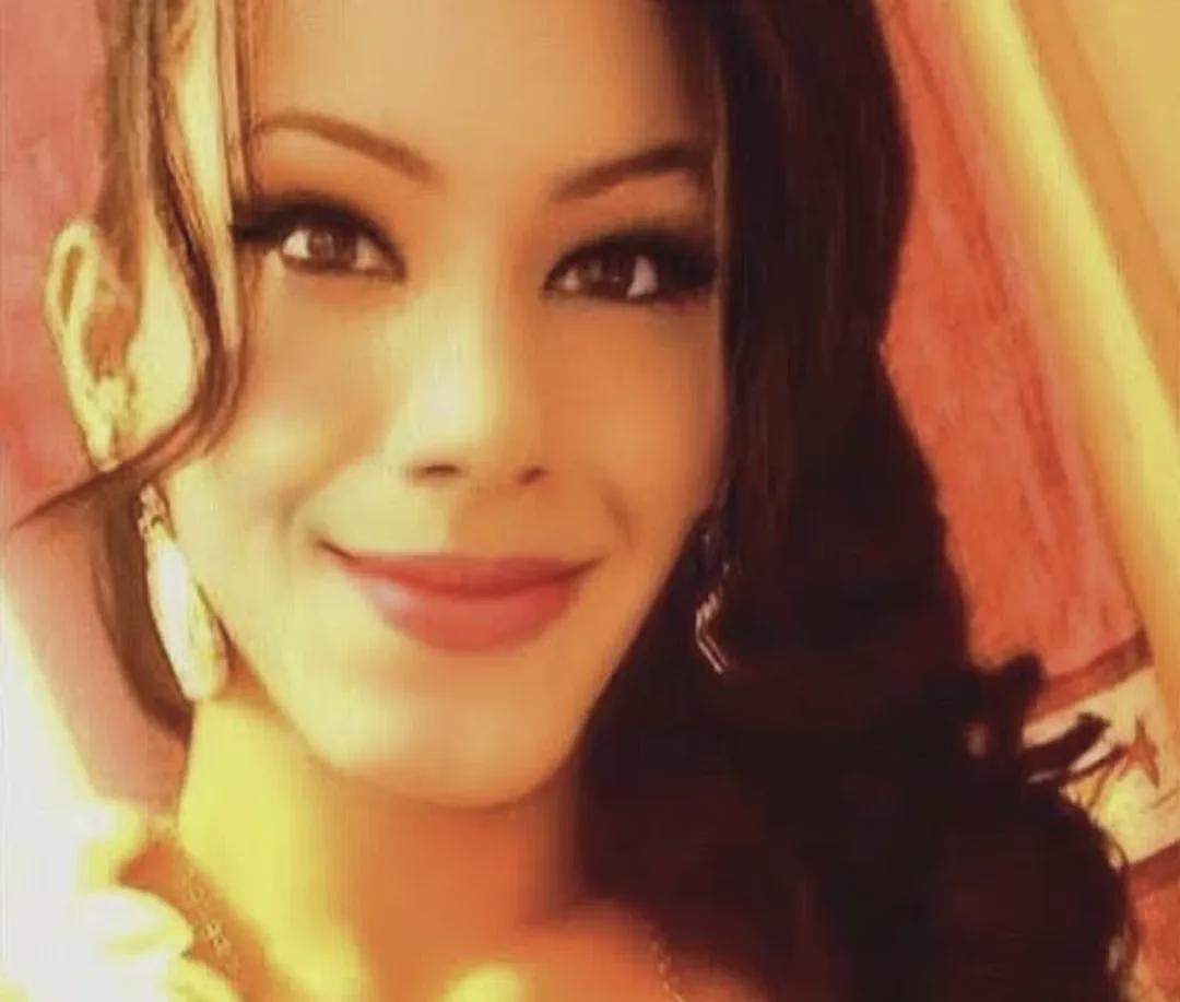 百万网红整容被注射21支矿物油+泻药!整张脸被毁,烂到变形!美国22名女子送医(组图) - 3
