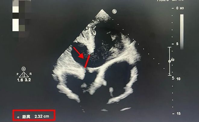 广东14岁男孩半年长胖20斤，得知原因后网友哭了！（组图） - 13
