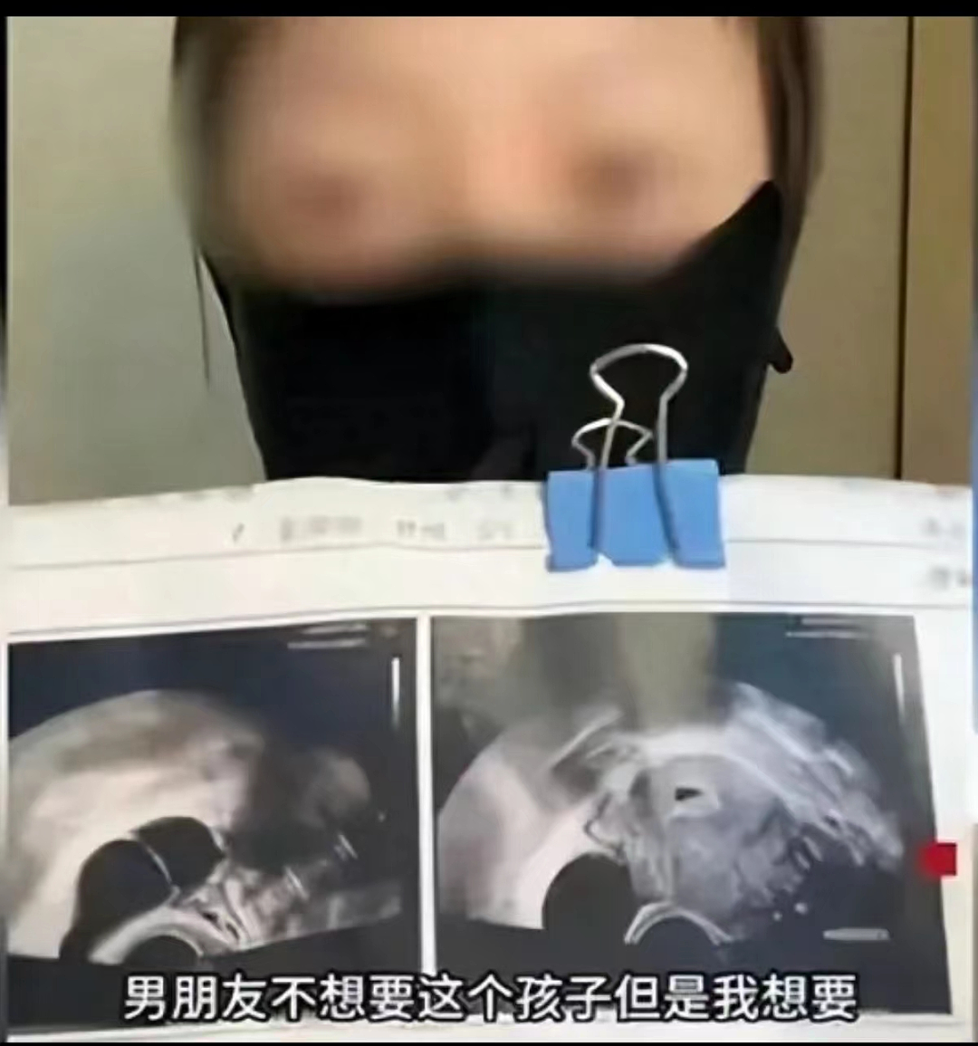 北京31岁男医生给女友下堕胎药,监控曝光她也不无辜…(组图) - 1