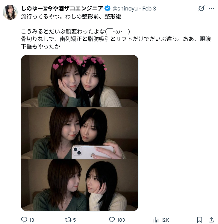 日本一樱花妹晒AI合照：和整形前的自己同框，意外爆火！看哭全网……（组图） - 5