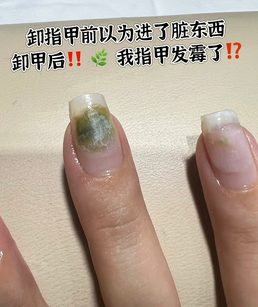 湖北女子感染HPV，回家过年的第一批“受害者”出现了…（组图） - 15