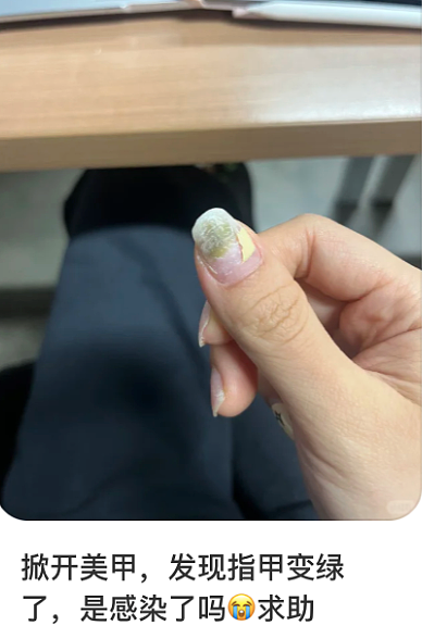 湖北女子感染HPV，回家过年的第一批“受害者”出现了…（组图） - 13