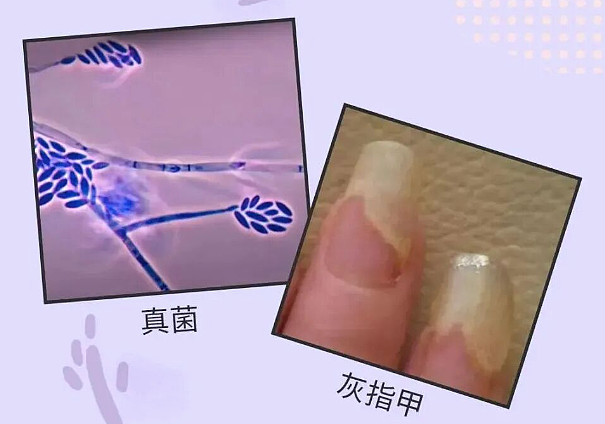 湖北女子感染HPV，回家过年的第一批“受害者”出现了…（组图） - 14