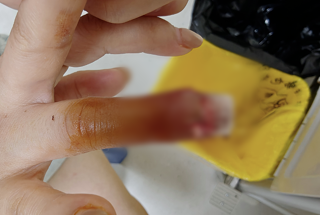 湖北女子感染HPV，回家过年的第一批“受害者”出现了…（组图） - 12