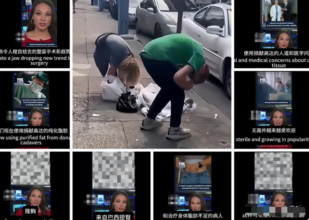 美国用死人的脂肪做整形填充,据说效果爆好,供不应求??网友慌了(组图) - 2