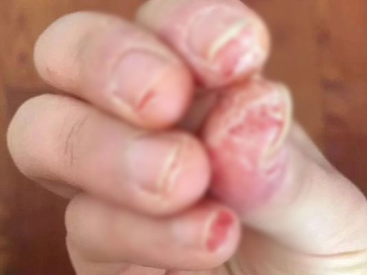 湖北女子感染HPV，回家过年的第一批“受害者”出现了…（组图） - 18