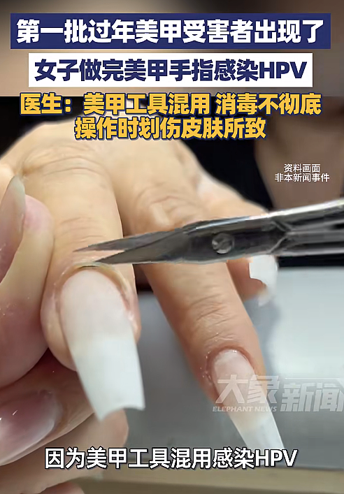 湖北女子感染HPV，回家过年的第一批“受害者”出现了…（组图） - 3