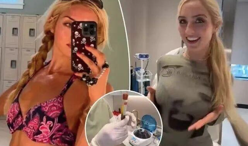 美国用死人的脂肪做整形填充,据说效果爆好,供不应求??网友慌了(组图) - 4