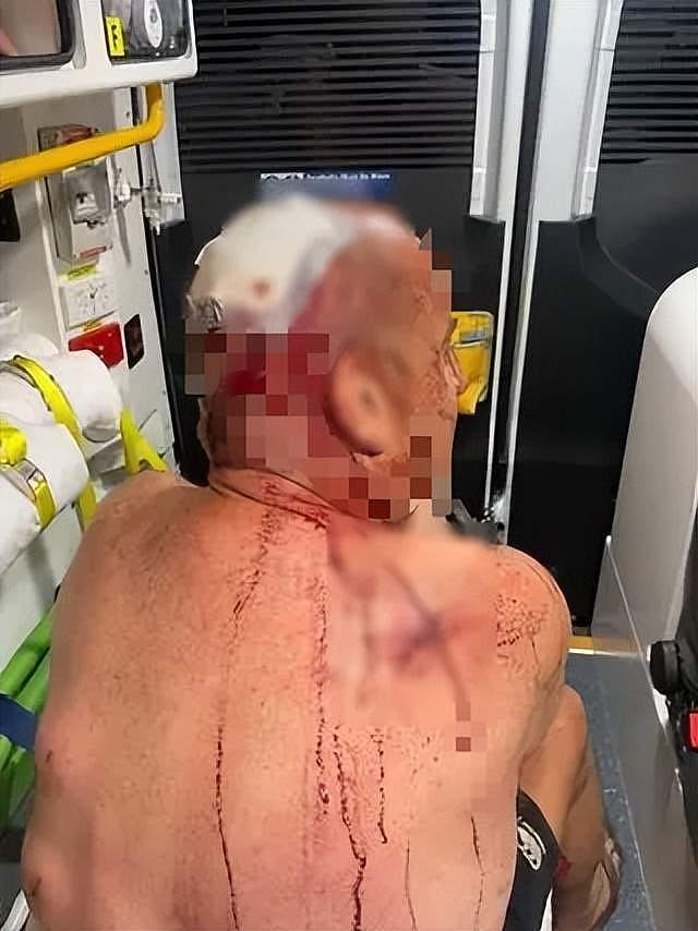 澳洲男子为救狗与袋鼠打架,被按地上暴揍,浑身是血万幸捡回一命(组图) - 2