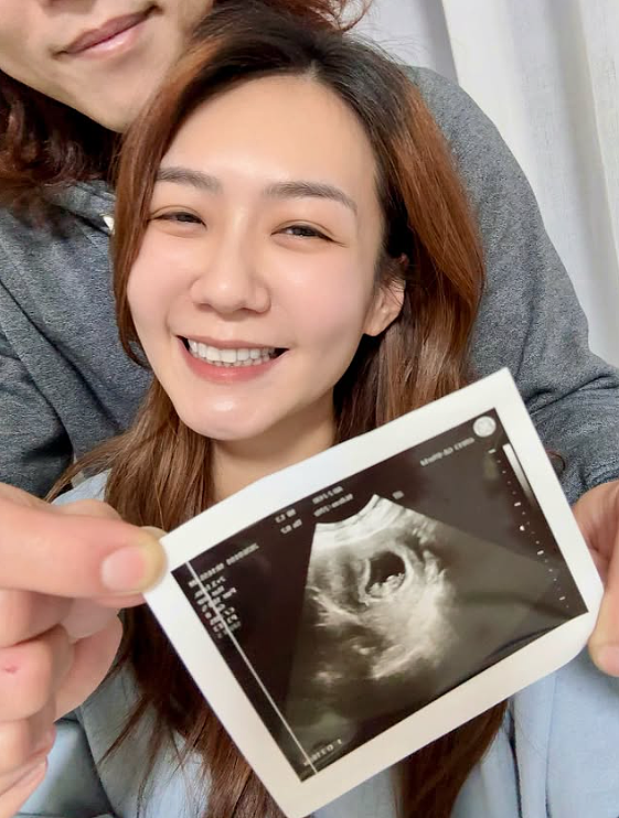 八点档女星认“怀孕后性欲变强”，狂做春梦：这样正常吗？（组图） - 2