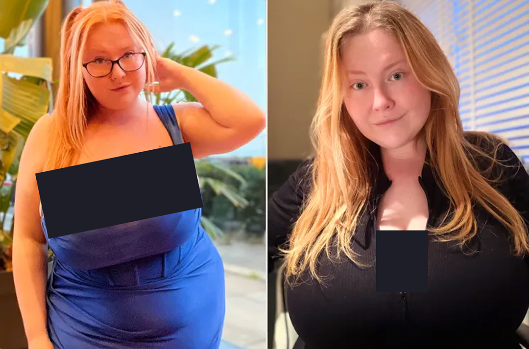 美女因N罩杯巨胸痛到想切掉！医生：这是病，切了可能长回来…（组图） - 2
