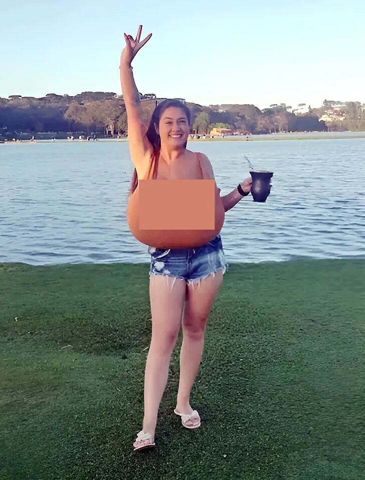 美女因N罩杯巨胸痛到想切掉！医生：这是病，切了可能长回来…（组图） - 14