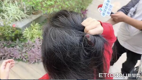 下体遭踢裂爆血!37岁妈遭压地狂踹,泪控:差点死在汉神巨蛋(组图) - 1