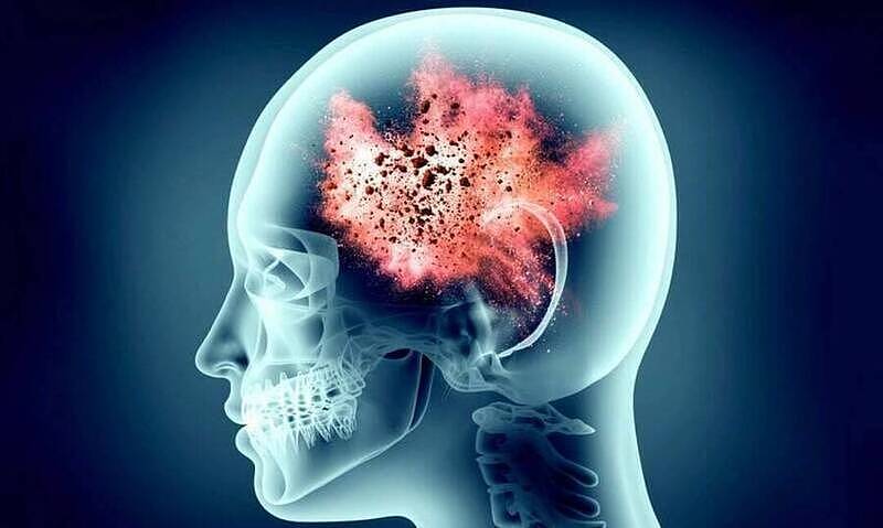 1/3人脑中有寄生虫？研究揭人体“自毁开关”（图） - 1
