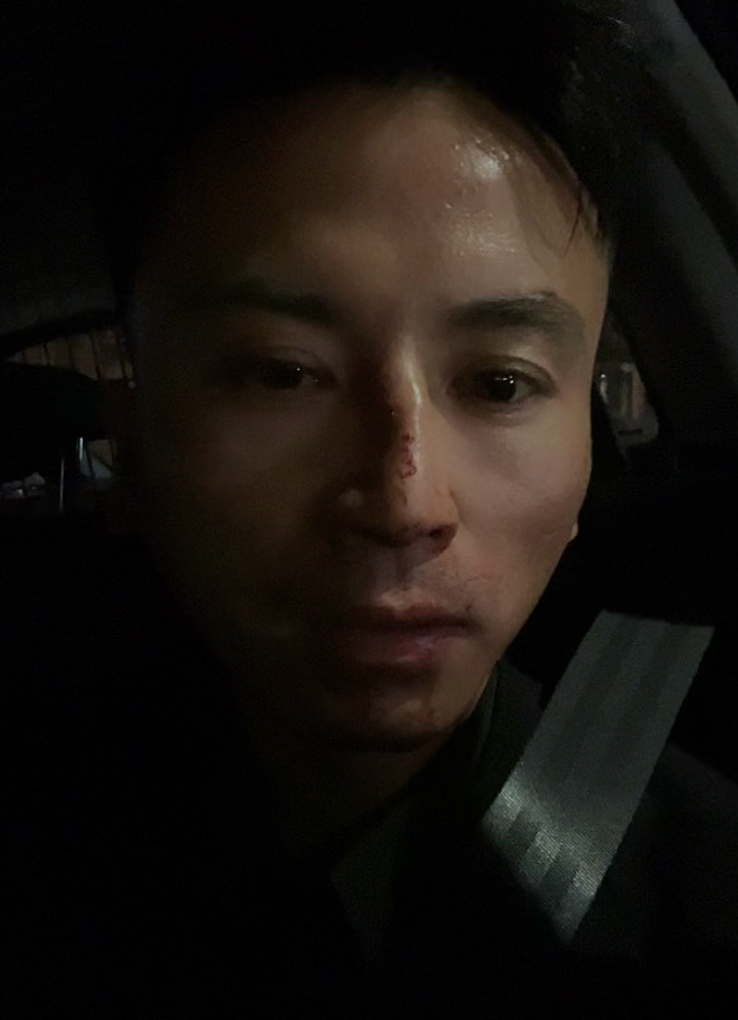 太心酸！华人网红街头直播遭十多人围殴抢劫， 满手鲜血， 鼻梁骨折，几十万人围观（组图） - 3