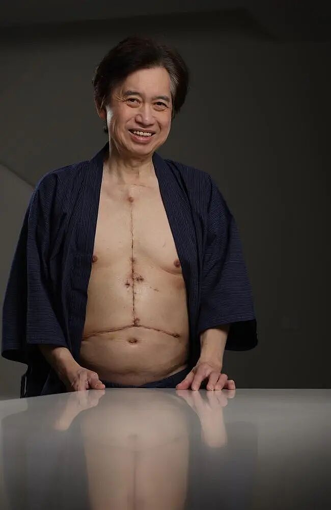 澳华男心脏停跳40分钟，体内血液被抽干！活着走下手术台（组图） - 1