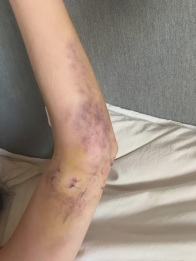 女提琴家在普拉提机器上摔成瘫痪，事业家庭尽毁，商家却否认责任，她秘密伪装取证最终成功胜诉...（组图） - 5