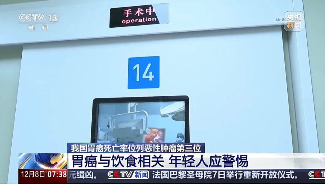 全球40%的胃癌，发生在中国（组图） - 6