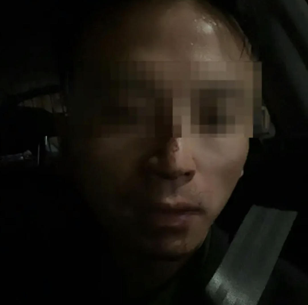 太心酸！华人街头直播遭十多人围殴抢劫，鼻梁骨折，满手鲜血！几十万人围观（组图） - 3