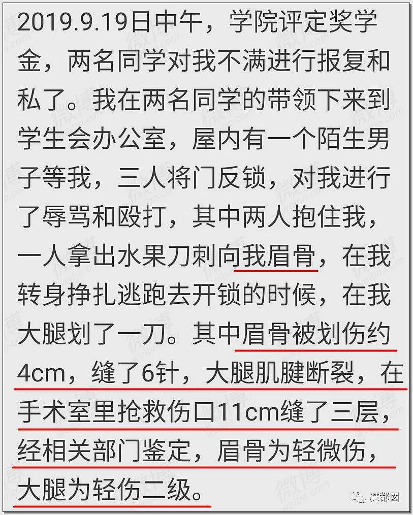 平顶山最新通报披露:先打3人再暴打15岁女孩;女孩被继父威胁,帮凶竟是妈妈(视频/组图) - 3