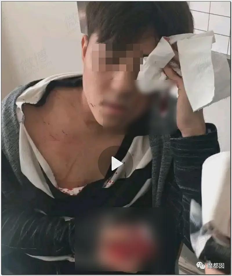 平顶山最新通报披露:先打3人再暴打15岁女孩;女孩被继父威胁,帮凶竟是妈妈(视频/组图) - 4