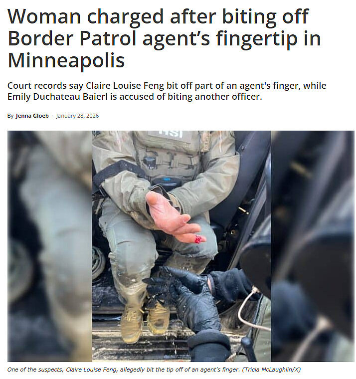 失控了！抗议现场华女咬断联邦探员手指尖，遭联邦重罪起诉（组图） - 2