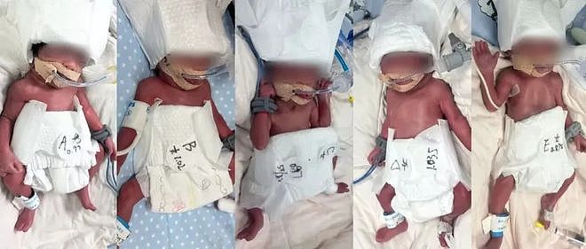 概率六千万分之一！新疆24岁产妇在武汉诞下“一兄四妹”五胞胎（组图） - 1