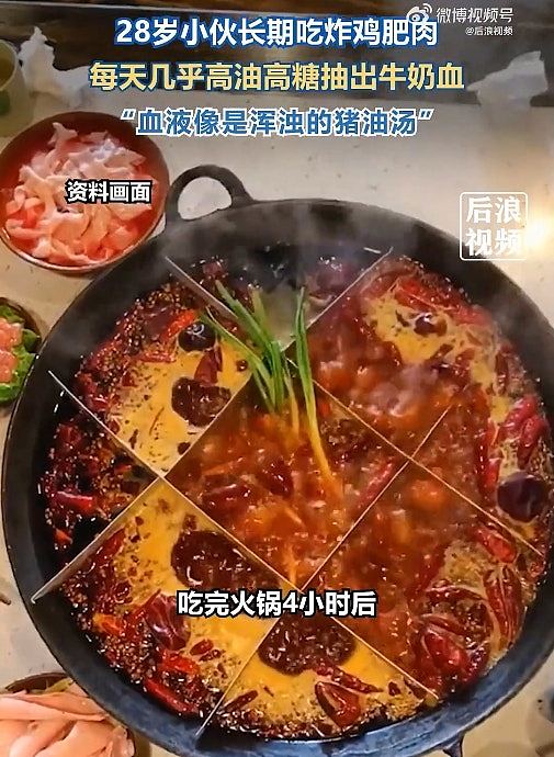 男子爱吃炸鸡喝汽水，突腹痛送医检查惊见“猪油血”，连医护都吓到了（组图） - 5