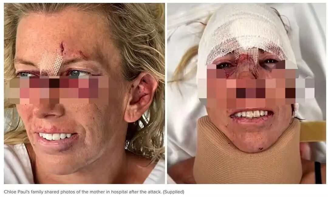 “拳击经验救了我的命”,悉尼三娃宝妈回忆惊魂一刻!涉事警员接受审查(组图) - 6