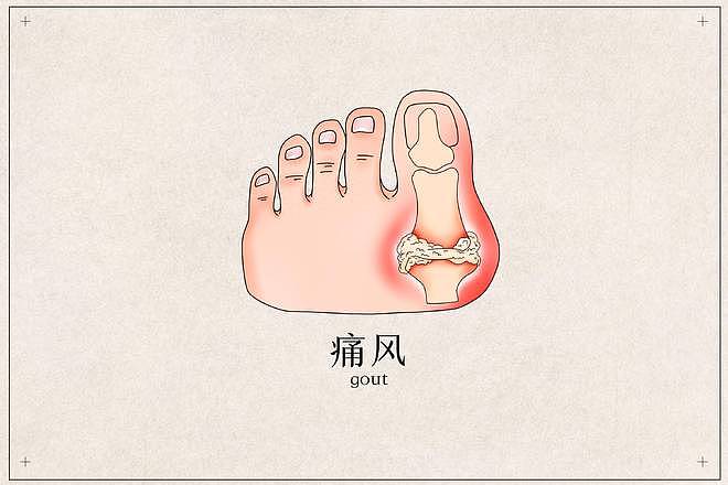 父母若是有以下7种疾病，子女基本都会遗传（组图） - 8