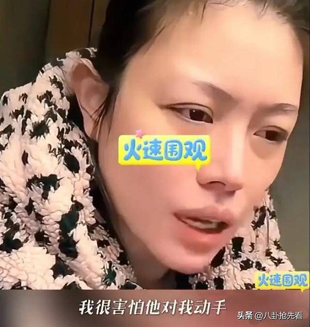 39岁葛荟婕官宣分手,自曝男友吃软饭还家暴,难怪她总折腾汪峰(组图) - 10