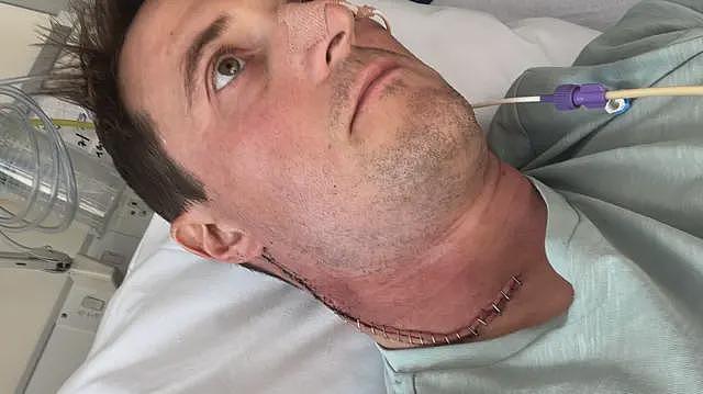 因癌症差点失去舌头的父亲，呼吁男性认识HPV（组图） - 4