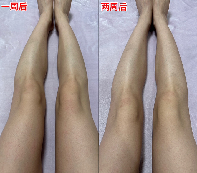 浴见修护身体油霜：令人惊艳的肤感！丝质油霜，一抹化油！为东方干敏肌专研的霜感身体油（组图） - 37