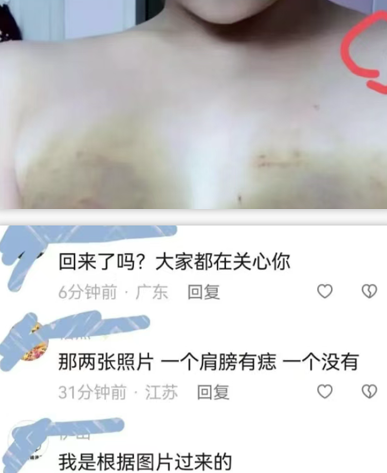 白富美女神“雅典娜”被闺蜜骗到菲律宾失联：网传被虐图和生活照对比太惨烈（组图） - 12