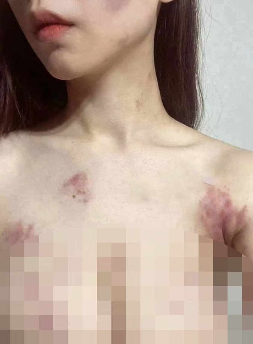 白富美女神“雅典娜”被闺蜜骗到菲律宾失联：网传被虐图和生活照对比太惨烈（组图） - 8
