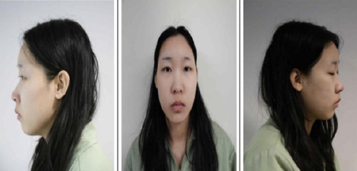 45岁台湾女子用老鼠药果汁3次毒杀澳籍小男友?其英籍丈夫或也因中毒而死(组图) - 2