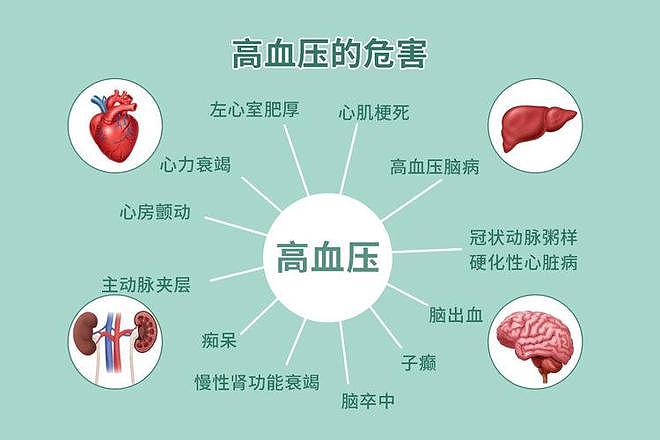 运动降压“实锤”!英国研究:这3类运动降血压最佳,不是跑步(组图) - 3