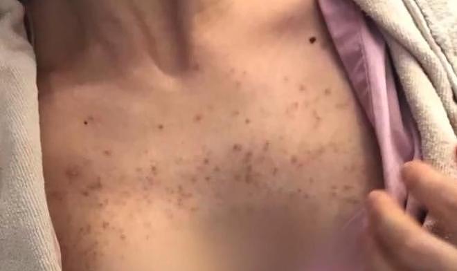 管住嘴！315爆雷的这五样食品，轻则生病重则致癌，一个都不能吃（组图） - 25
