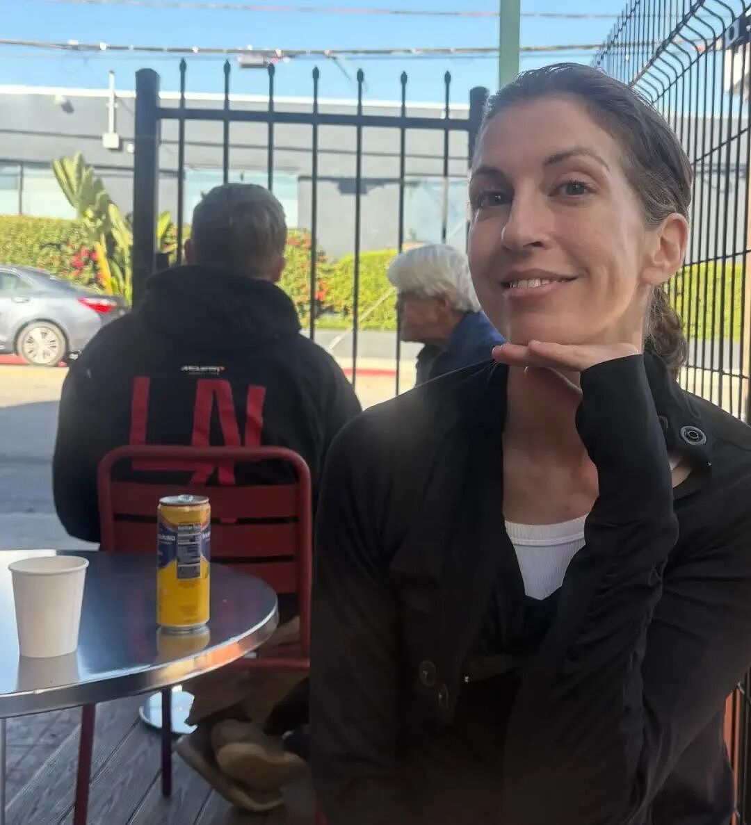 女义工给流浪汉发食物，竟被人砸碎下巴！6颗牙被打飞 铁管偷袭（组图） - 1