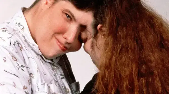 世界最老连体双胞胎姐妹变兄妹！姐姐公开变性，称瞒了妹妹46年？（组图） - 1