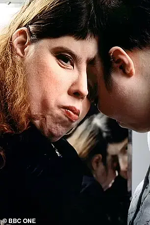 世界最老连体双胞胎姐妹变兄妹！姐姐公开变性，称瞒了妹妹46年？（组图） - 16