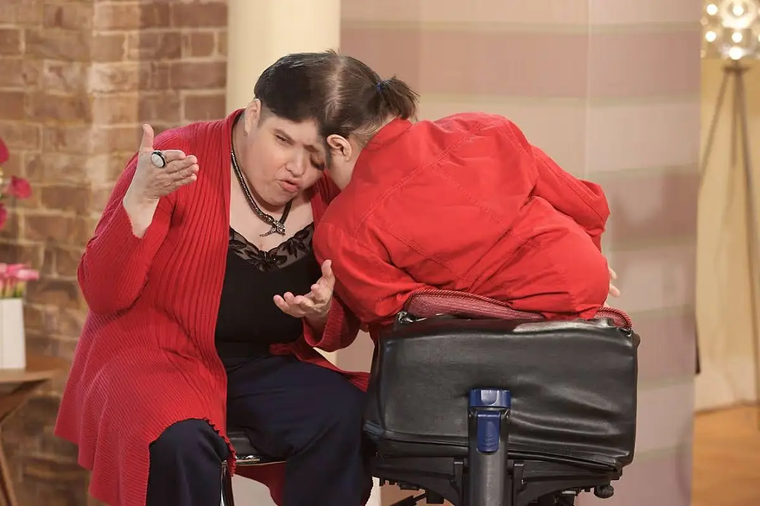 世界最老连体双胞胎姐妹变兄妹！姐姐公开变性，称瞒了妹妹46年？（组图） - 13